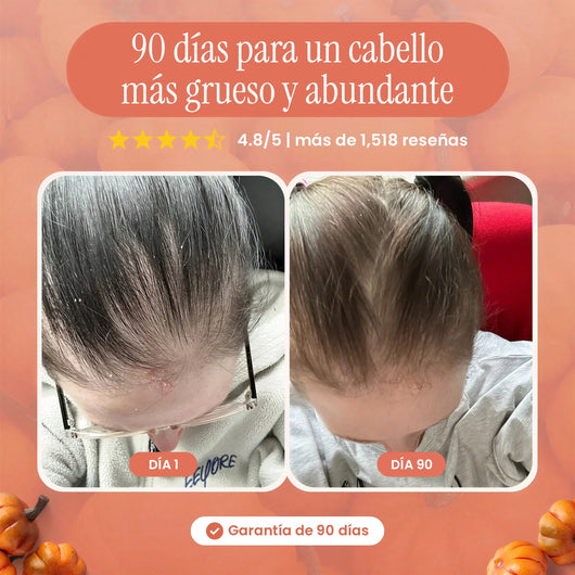 Día 1 y día 90 con Hair Bond, con garantía de 90 días