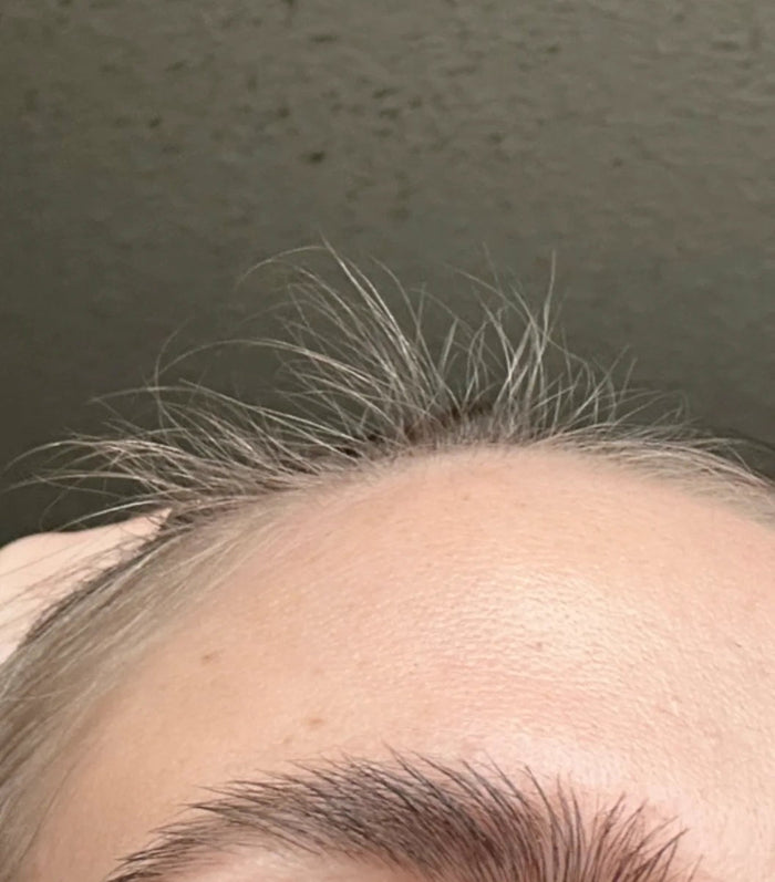 Pelitos nuevos donde se parte el pelo y en las entradas